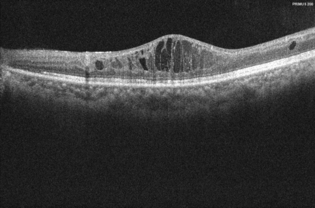 唐先生治疗前影像检查